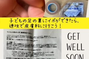 ウイルス性のイボ